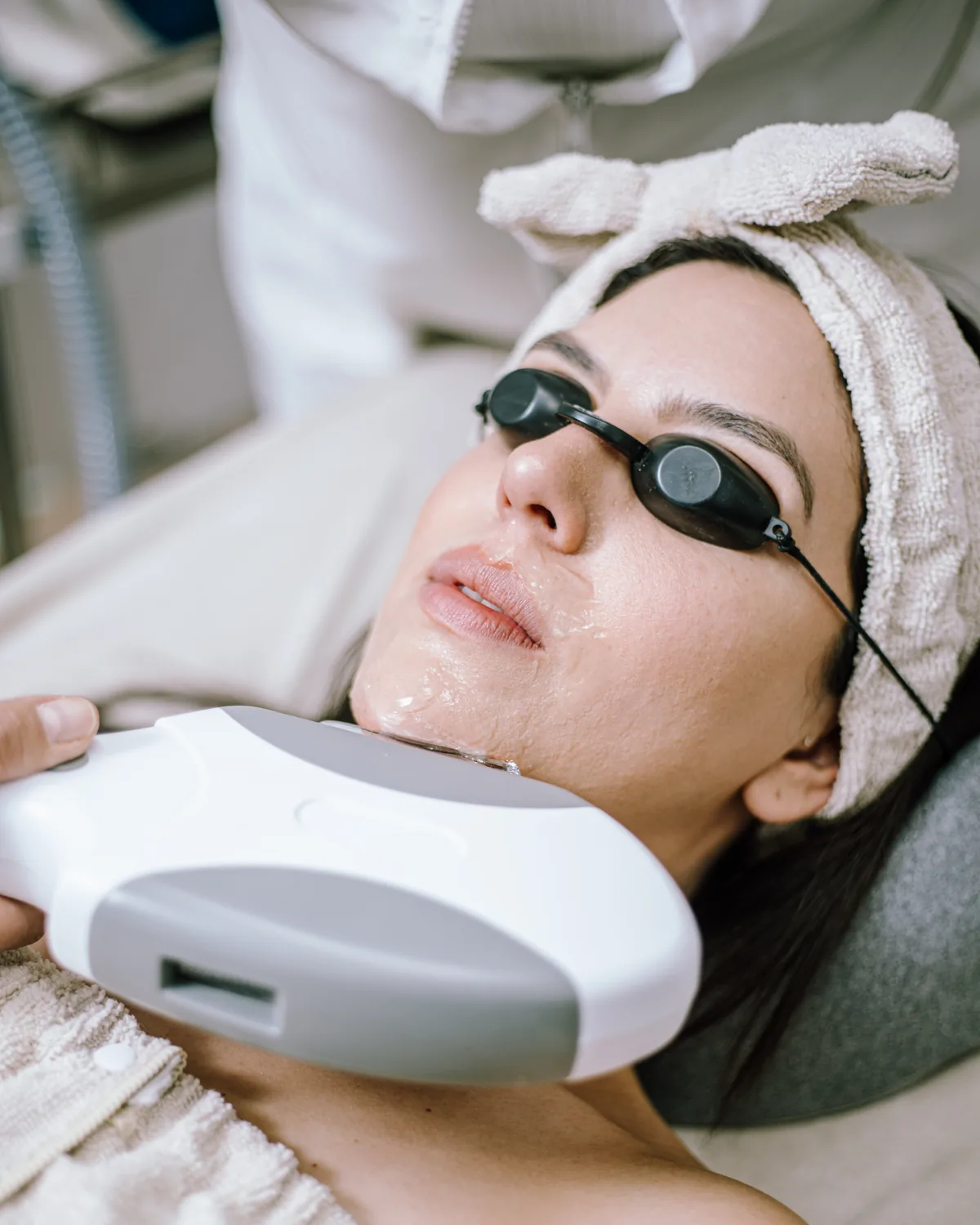 Tratamiento facial en Acné Faciales Irapuato