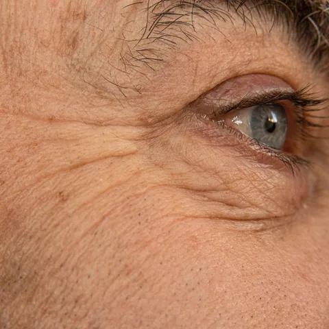 Rostro con líneas de expresión